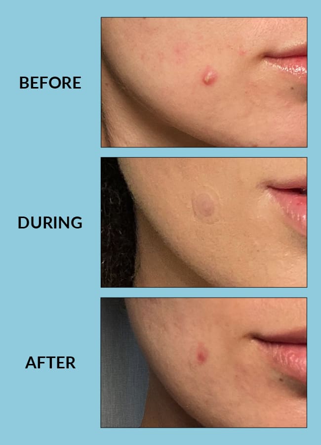 Free Skin Patches