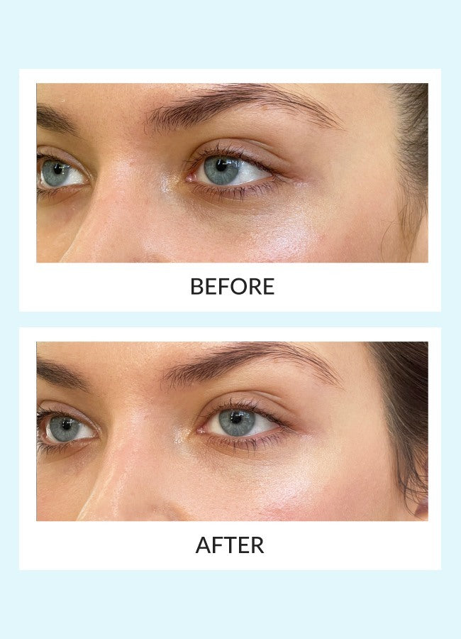 Reusable Eye Therapy Patches Refill
