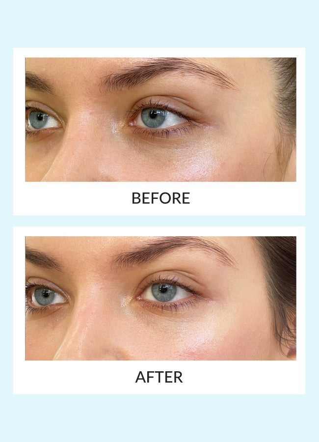 Reusable Eye Therapy Patches Solo