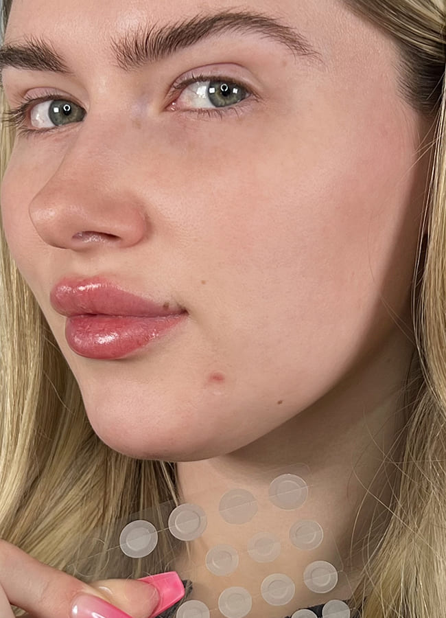 Free Skin Patches